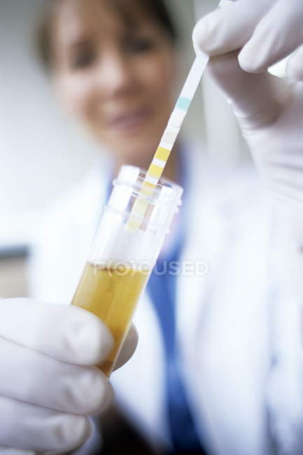 Nahaufnahme von mehreren Teststäben, die von einer Ärztin in ein Urinprobenröhrchen gelegt werden. — Stockfoto