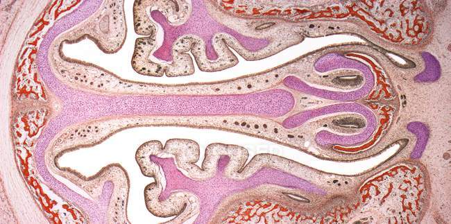 Micrografía ligera (LM) de los senos nasales (recubierta por epitelio marrón) y los cartílagos de soporte (rosa
). - foto de stock