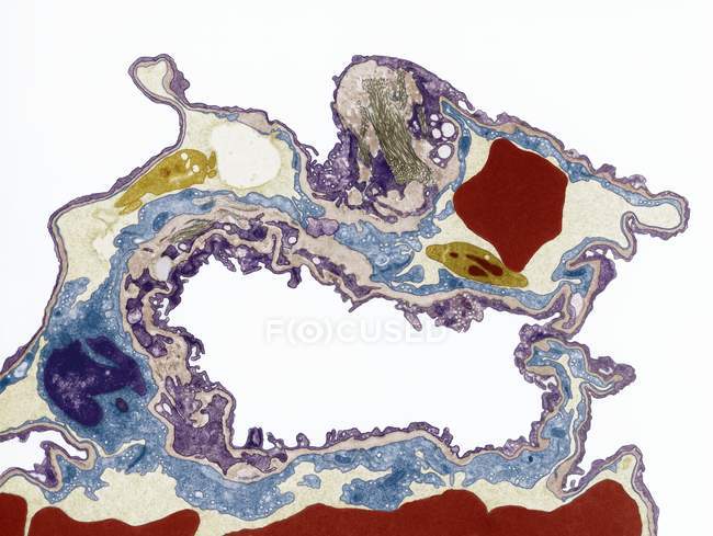 Tissu pulmonaire, micrographie électronique par transmission colorée (TEM) ). — Photo de stock
