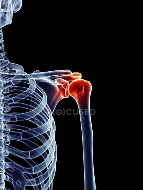 Area di infiammazione dell'articolazione della spalla — Foto stock