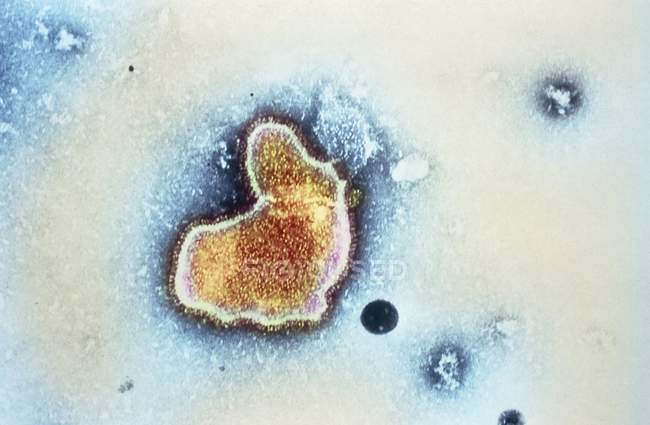 Virus sincitial respiratorio - foto de stock