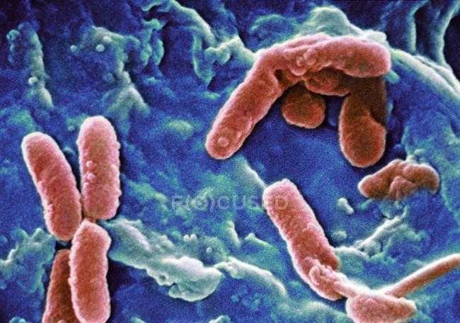 Bactéries Pseudomonas aeruginosa — Photo de stock