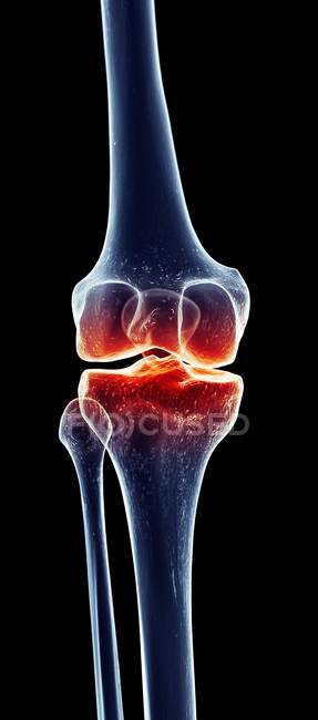 Dolore alle articolazioni del ginocchio umano — Foto stock
