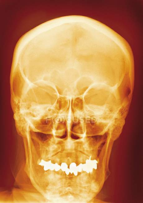 Нормальная структура черепа молодого человека — стоковое фото