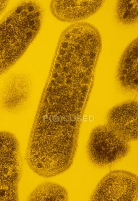Bactéries Gardnerella vaginalis — Photo de stock