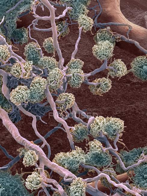 Glomérulos renais, micrografia eletrônica de varredura colorida (SEM
). — Fotografia de Stock