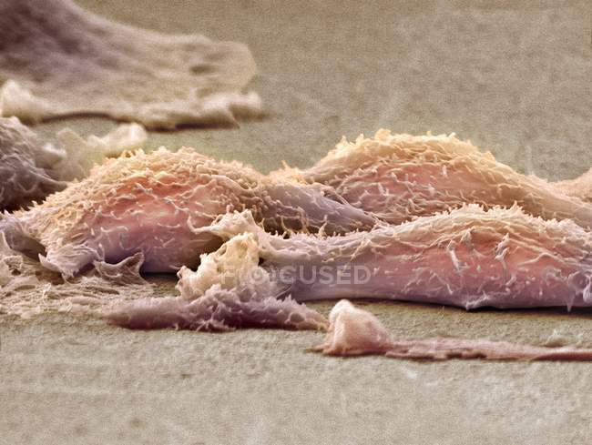 Micrografía electrónica de barrido (SEM) de células del sarcoma en cultivo
. - foto de stock