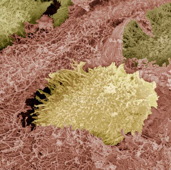 Cartílago hialino, un tejido conectivo semirrígido - foto de stock