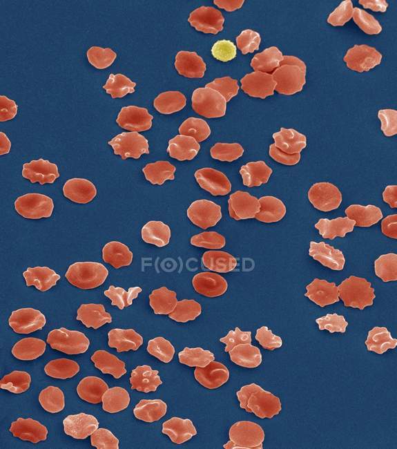Globules rouges crénelés — Photo de stock
