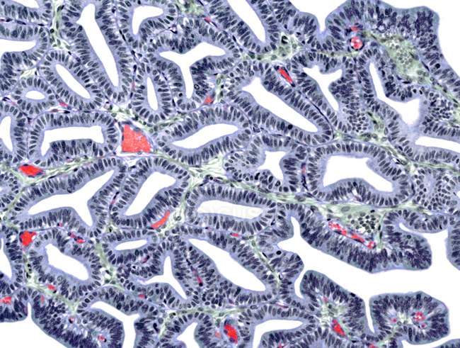 Фаллопиевая клеточная структура — стоковое фото