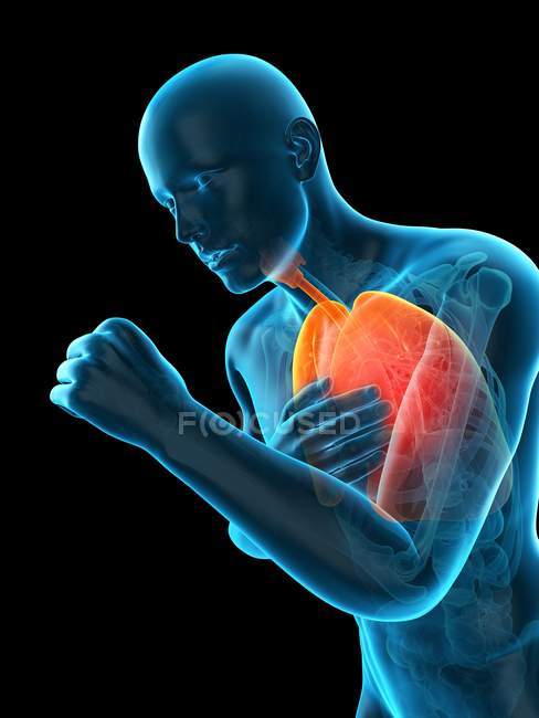 Anatomia da tosse de pessoa — Fotografia de Stock