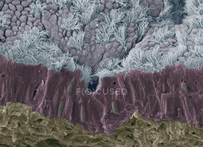 Micrógrafo electrónico de barrido coloreado (SEM) de una membrana mucosa fracturada de la tráquea (tubo de viento), que muestra el epitelio y el tejido conectivo subyacente
. - foto de stock
