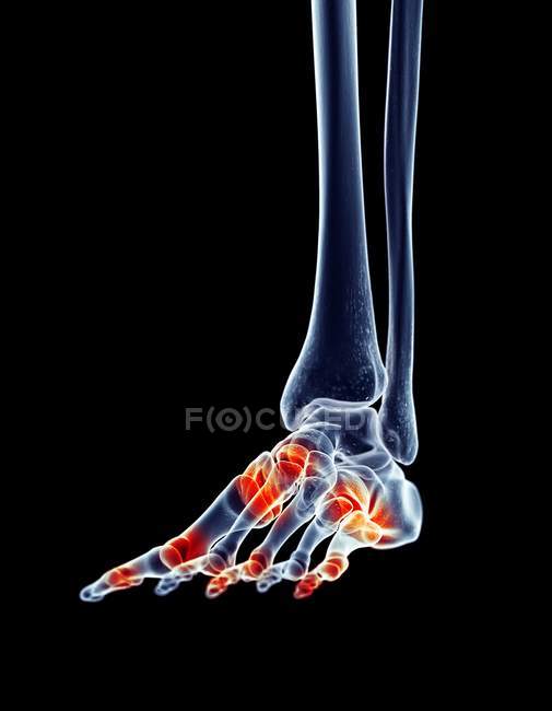 Pain localized in foot — Stock Photo