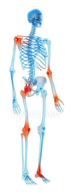 Shoulder and waist joints pain — Stock Photo