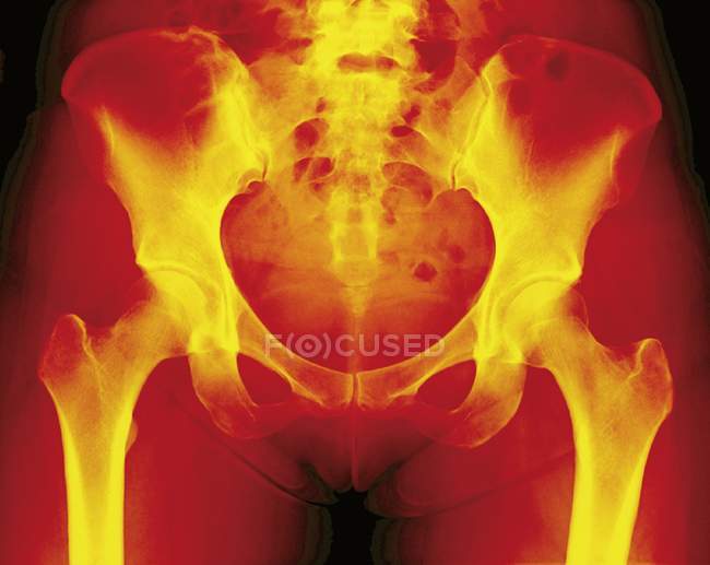 Normal female pelvis — Stock Photo