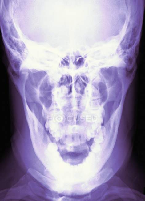 Struttura normale del cranio di un giovane adulto — Foto stock