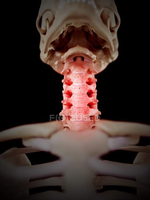 Dolore al collo che colpisce le vertebre cervicali — Foto stock