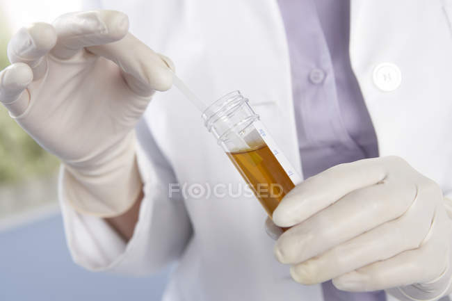 Medizinisches Personal behandschuhte Hände halten Teststab in Urinprobenröhrchen. — Stockfoto