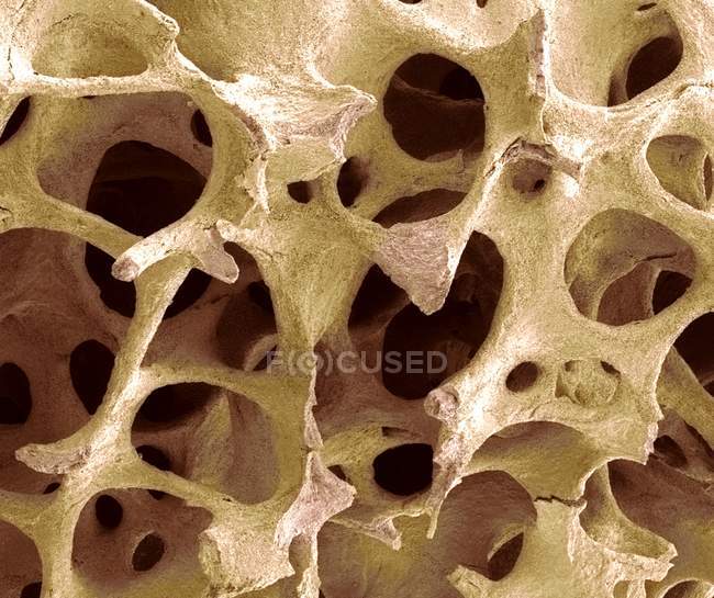 Отменные костные ткани — стоковое фото