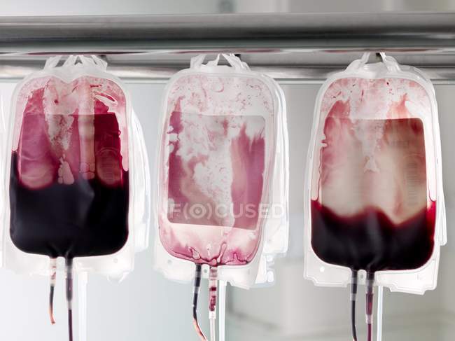 Sangue de doador em sacos de sangue, close-up . — Fotografia de Stock