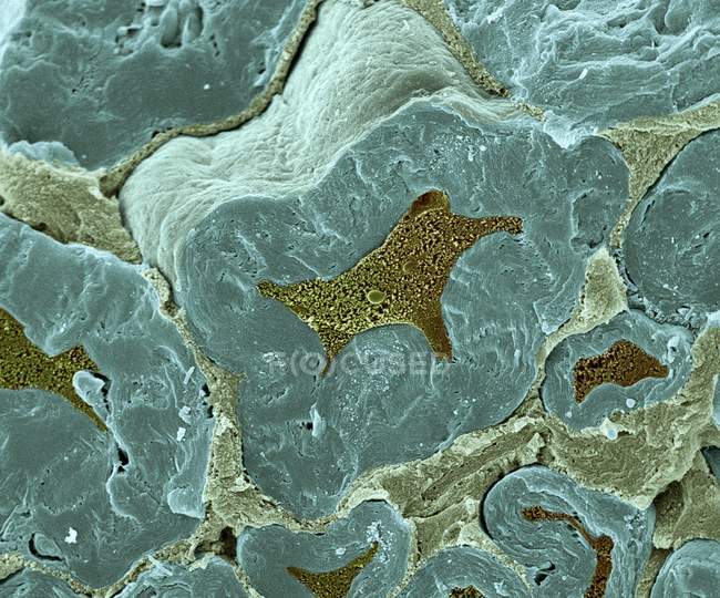 Перелом миелинизированных нервных волокон — стоковое фото