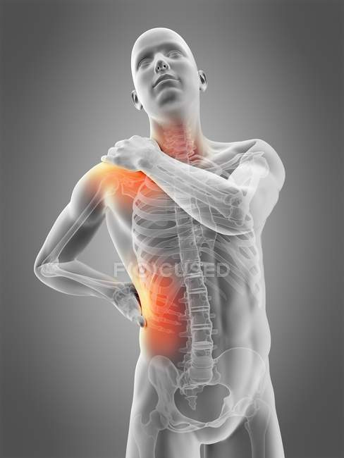 Localização da dor no ombro e na cintura — Fotografia de Stock
