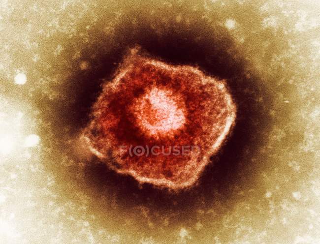 Partícula del virus varicela zoster - foto de stock