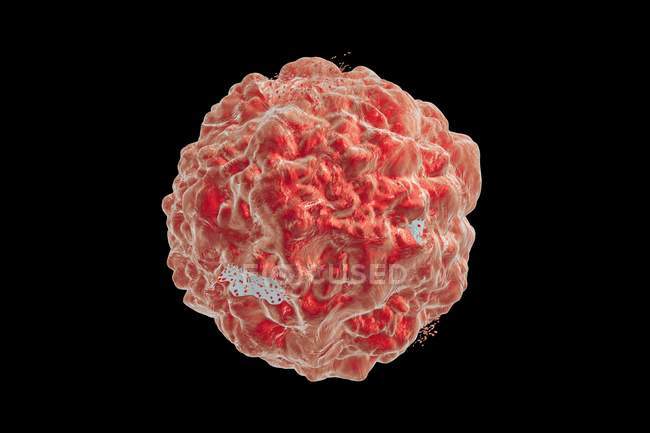 Destrucción de una célula cancerosa por anticuerpos - foto de stock