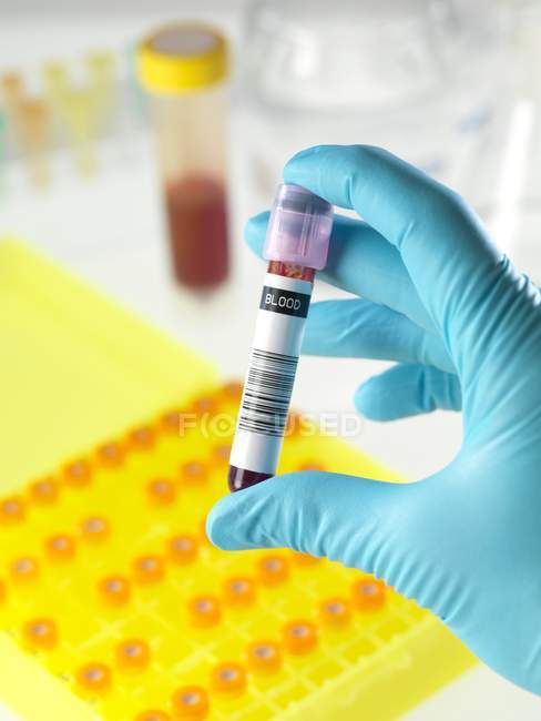 Researcher hand holding vacutainer tube in front of yellow tray. — Stock Photo