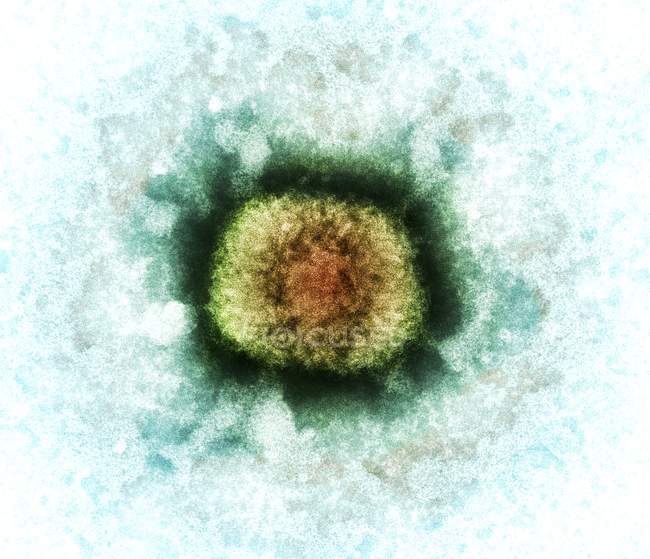 Partícula del virus de la vacuna - foto de stock