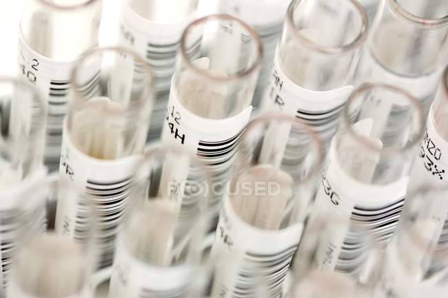 Códigos de barras en tubos de ensayo con muestras de sangre
. - foto de stock