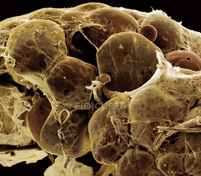 Tecido adiposo, micrografia eletrônica de varredura colorida (MEV). As células de gordura (adipócitos, redondos) são cercadas por fibras colágenas . — Fotografia de Stock