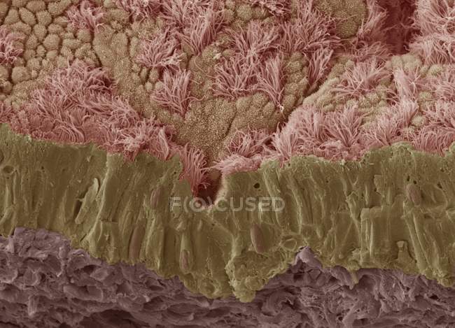 Micrógrafo electrónico de barrido coloreado (SEM) de una membrana mucosa fracturada de la tráquea (tubo de viento), que muestra el epitelio y el tejido conectivo subyacente
. - foto de stock