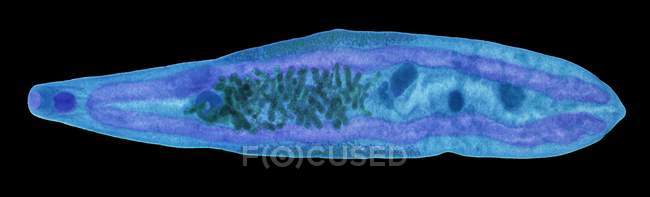 Gripe hepática Clonorchis sinensis - foto de stock