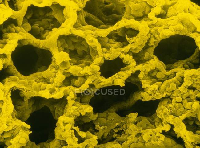 Micrographie électronique à balayage de fausses couleurs d'une section de tissu pulmonaire sain, montrant les sacs d'air microscopiques (alvéoles) où l'échange de gaz a lieu
. — Photo de stock