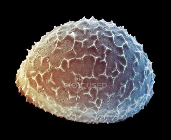 Liradiscus sp. Планктонные одноклеточные водоросли — стоковое фото