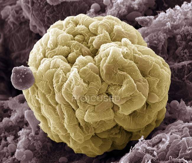 Гломерулус нирки та клітини підоцитів — стокове фото
