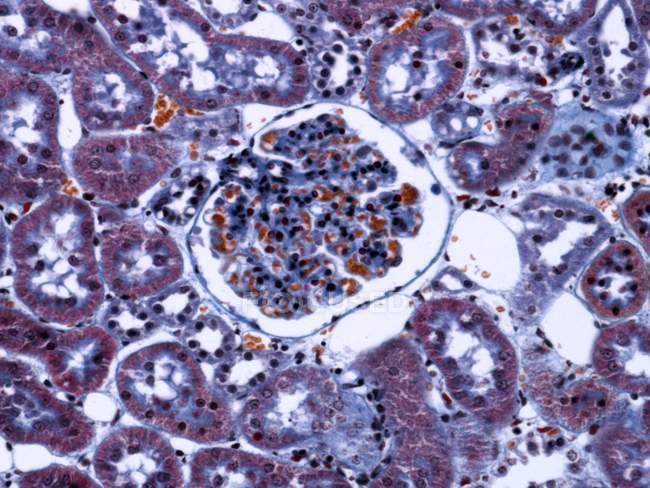 Kidney glomerulus and podocyte cells — Stock Photo