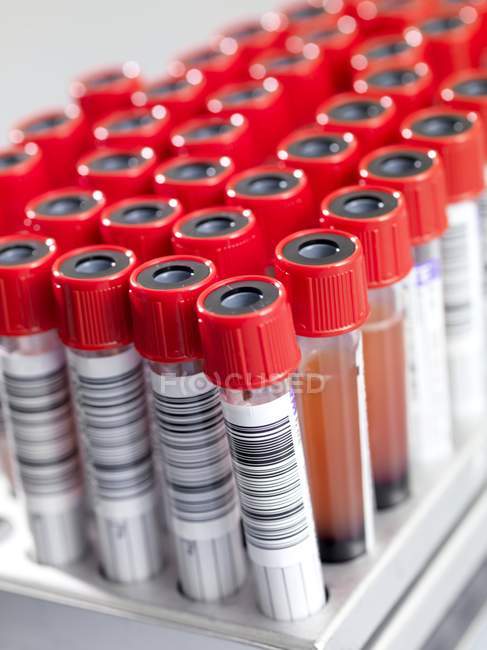 Tubes d'aspirateur étiquetés contenant des échantillons de sang, gros plan . — Photo de stock