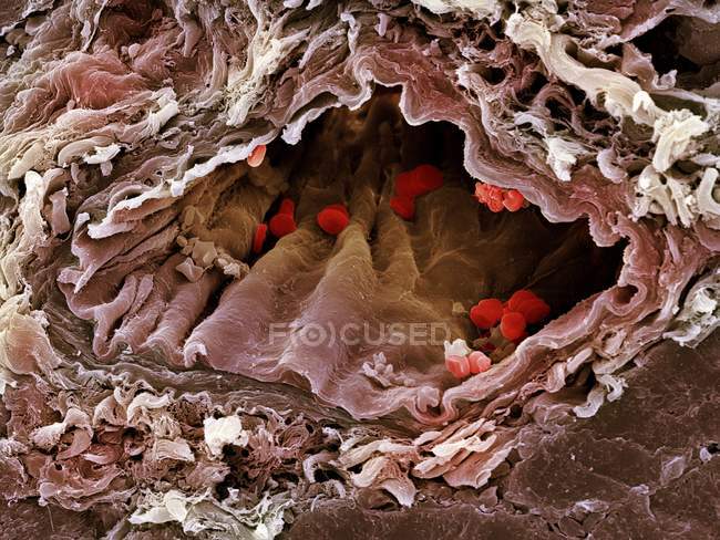 Micrógrafo electrónico de barrido coloreado (SEM) de una arteria seccionada que contiene glóbulos rojos (eritrocitos, rojos)
). - foto de stock