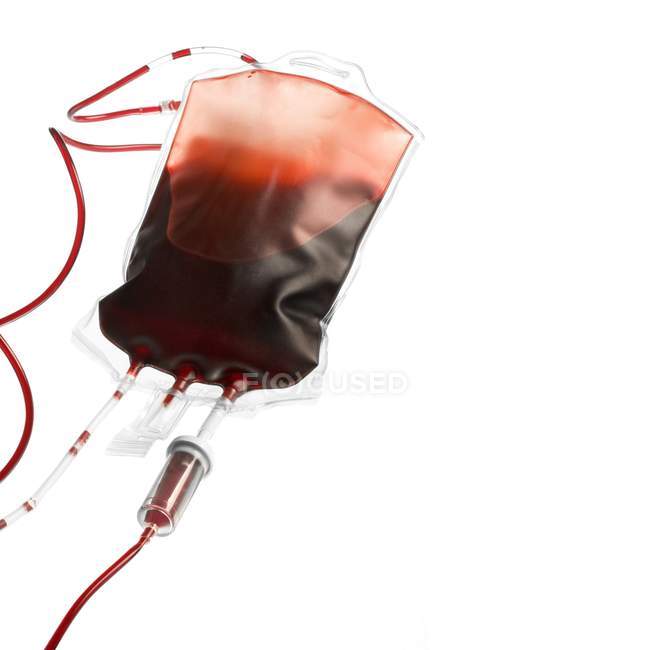Donated blood in plastic bag — Stock Photo