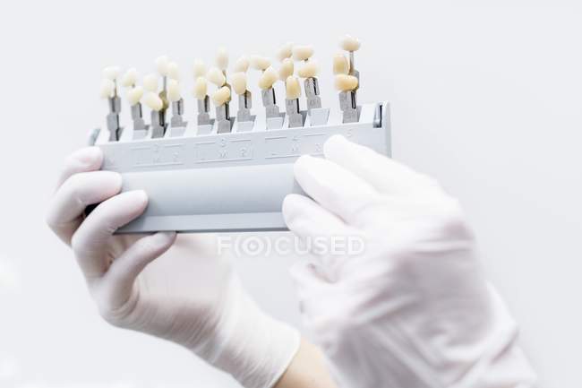 Dentista mãos segurando dentes branqueamentos na clínica odontológica . — Fotografia de Stock