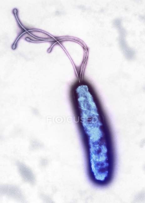 Helicobacter pylori bacterium — Stock Photo