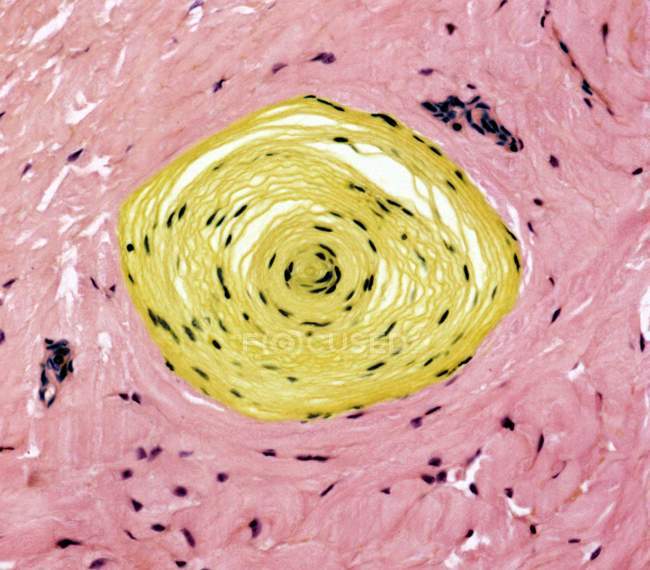 Section through a Pacinian corpuscle — Stock Photo