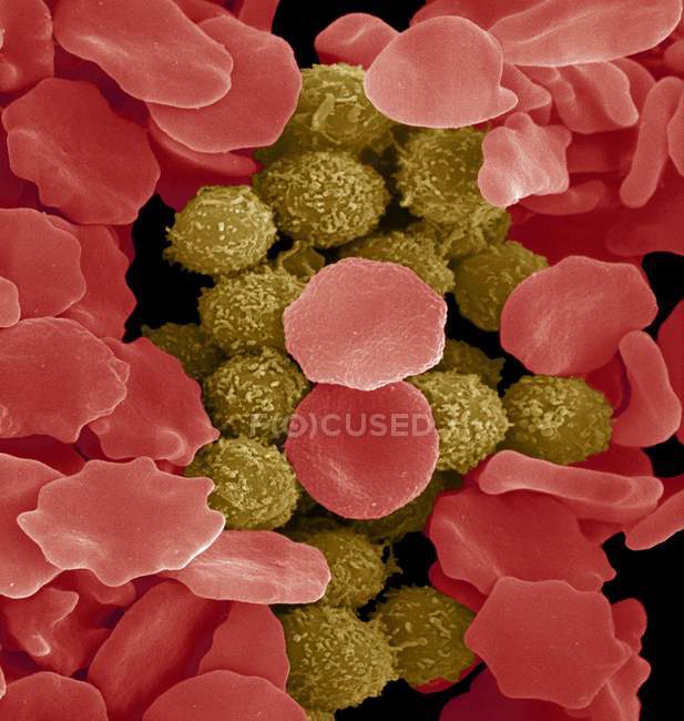 Red and white blood cells aggregating — Stock Photo