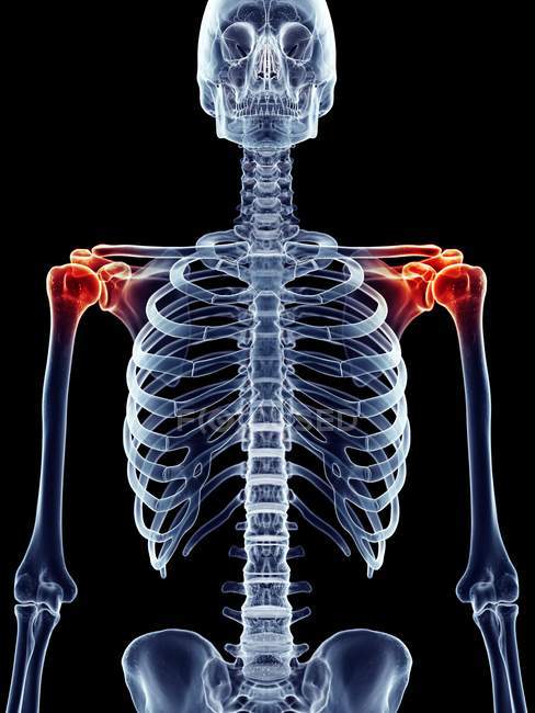 Area of inflammation in shoulder joint — Stock Photo