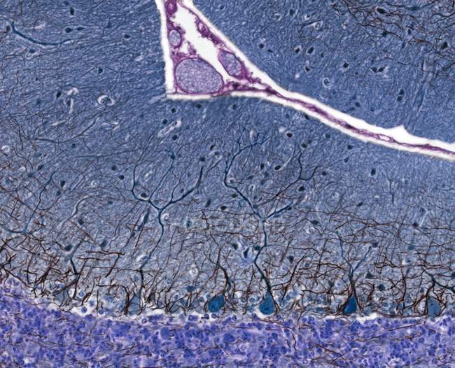 Пуркиньи клетки и их дендритные процессы — стоковое фото