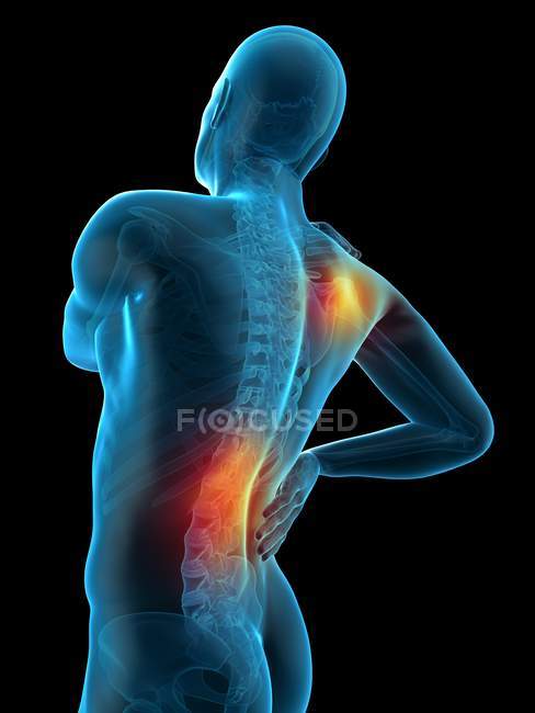 Localización del dolor de hombro y cintura - foto de stock