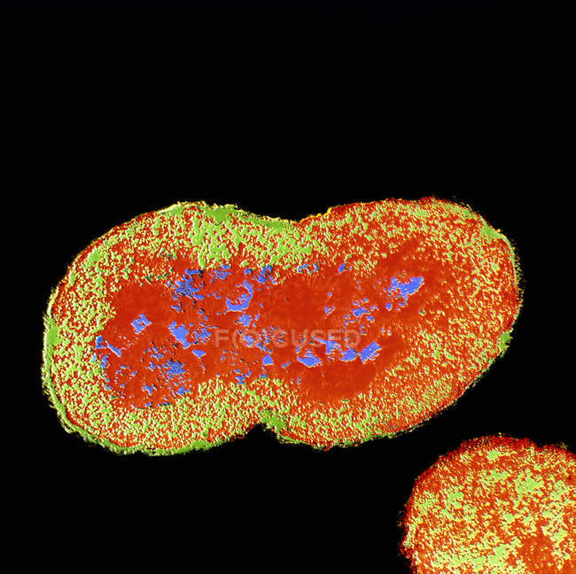 Neisseria gonorrhoeae bacteria - foto de stock