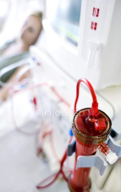 Primo piano del filtro esterno per il trattamento di pazienti con insufficienza renale
. — Foto stock
